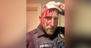 Two Marshfield officers injured during confrontation with aggressive suspect